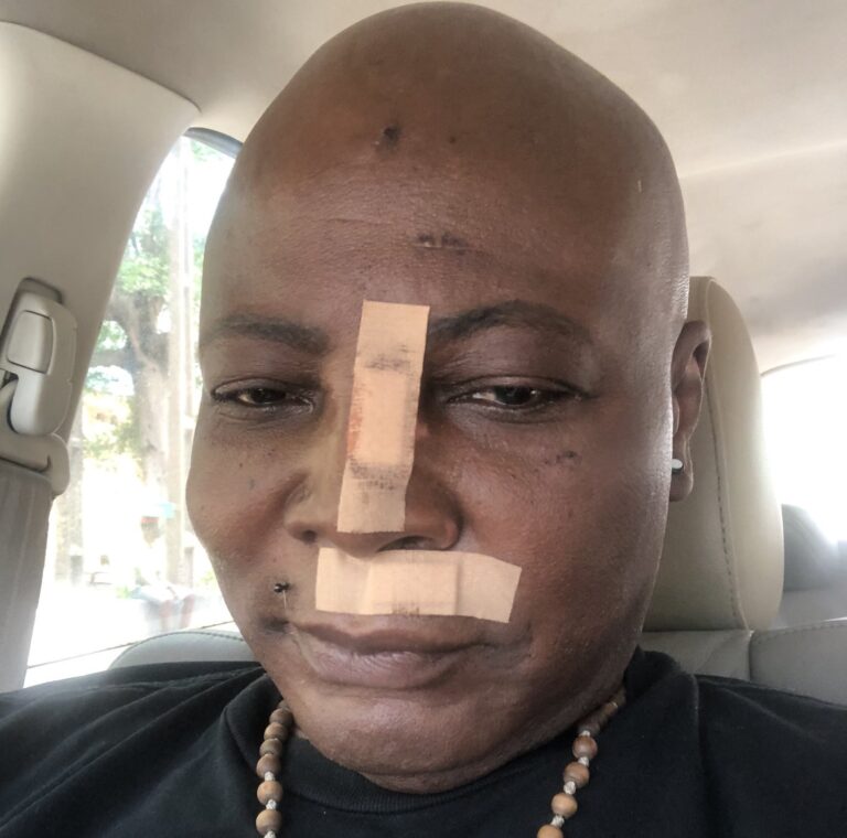 What Happened to Charly Boy?